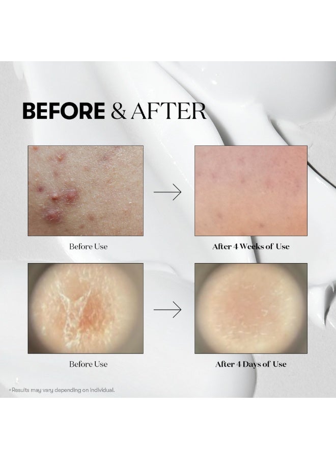 VT COSMETICS Mild Reedle Shot 50 50ml | Gentle Micro-Needling Essence for Sensitive Skin | Pore Care, Skin Texture Refining Serum - Image 4